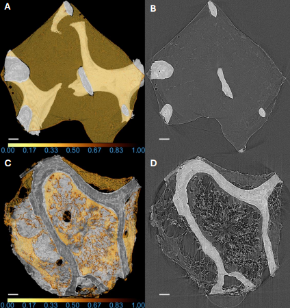 CLL microCT figure