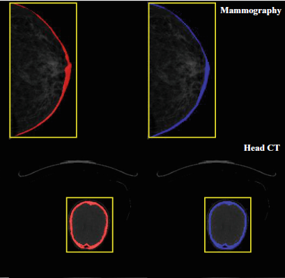 Gray’s Anatomy SAM figure